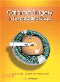 Cataract Surgery in Complicated Cases