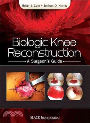 Biologic Knee Reconstruction ─ A Surgeon's Guide