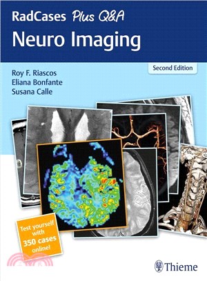 Neuro Imaging
