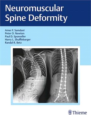 Neuromuscular Spine Deformity ― A Harms Study Group Treatment Guide