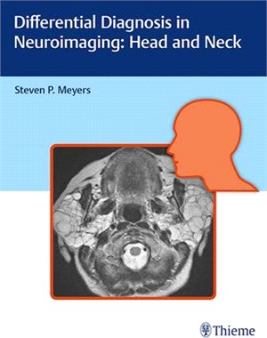 Differential Diagnosis in Neuroimaging ─ Head and Neck