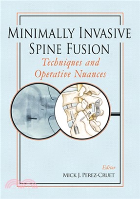 Minimally Invasive Spine Fusion: Techniques and Operative Nuances