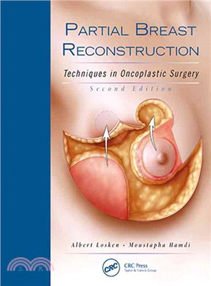 Partial Breast Reconstruction ― Techniques in Oncoplastic Surgery