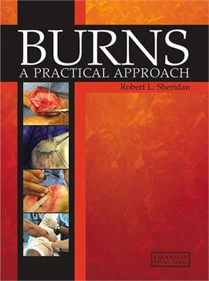 Burns ― A Practical Approach to Immediate Treatment and Long Term Care