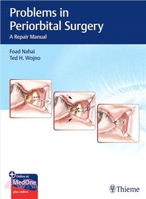 Problems in Periorbital Surgery ― A Repair Manual