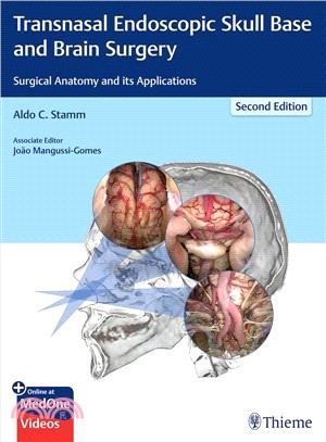 Transnasal Endoscopic Skull Base and Brain Surgery ― Surgical Anatomy and Its Applications