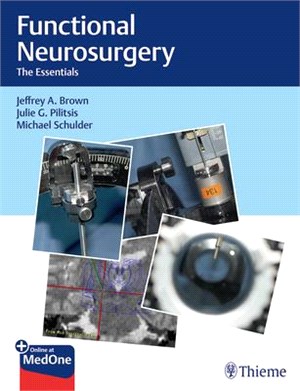 Functional Neurosurgery ― The Essentials