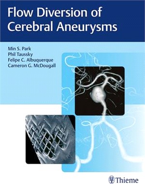 Flow Diversion of Cerebral Aneurysms