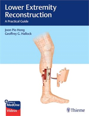 Lower Extremity Reconstruction ― A Practical Guide