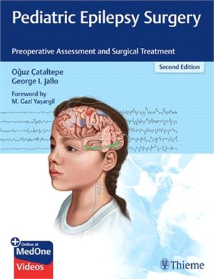 Pediatric Epilepsy Surgery ― Preoperative Assessment and Surgical Treatment