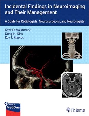 Incidental Findings in Neuroimaging and Their Management ― A Guide for Radiologists, Neurosurgeons, and Neurologists