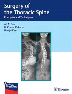 Surgery of the Thoracic Spine ― Principles and Techniques