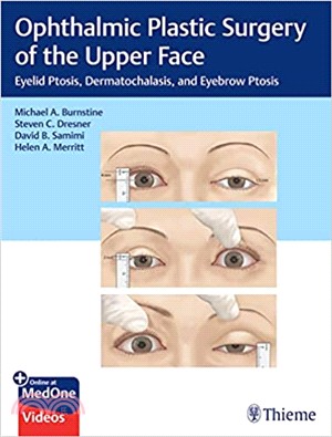 Ophthalmic Plastic Surgery of the Upper Face ― Eyelid Ptosis, Dermatochalasis, and Eyebrow Ptosis