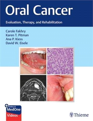 Oral Cancer ― Evaluation, Therapy, and Rehabilitation
