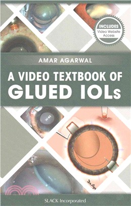 A Video Textbook of Glued Iols