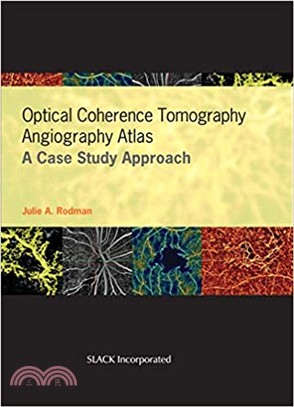 Optical Coherence Tomography Angiography Atlas ― A Case Study Approach
