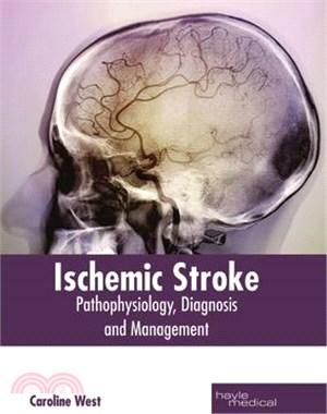 Ischemic Stroke ― Pathophysiology, Diagnosis and Management