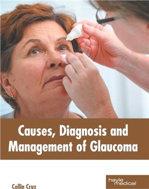 Causes, Diagnosis and Management of Glaucoma