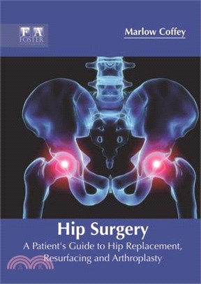 Hip Surgery ― A Patient's Guide to Hip Replacement, Resurfacing and Arthroplasty