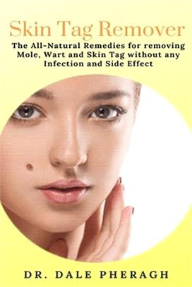 Skin Tag Remover: The All-Natural Remedies for removing Mole, Wart and Skin Tag without any Infection and Side Effect