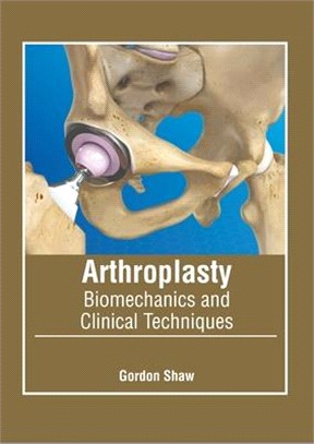 Arthroplasty: Biomechanics and Clinical Techniques