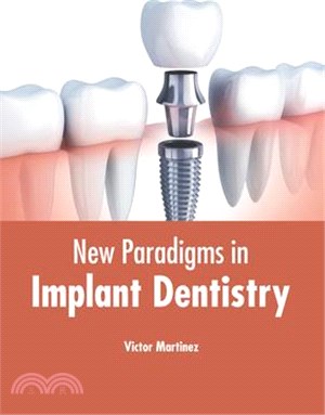 New Paradigms in Implant Dentistry