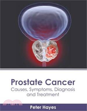 Prostate Cancer: Causes, Symptoms, Diagnosis and Treatment