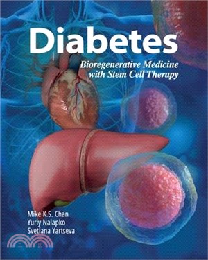 Diabetes: Bioregenerative Medicine with Stem Cell Therapy