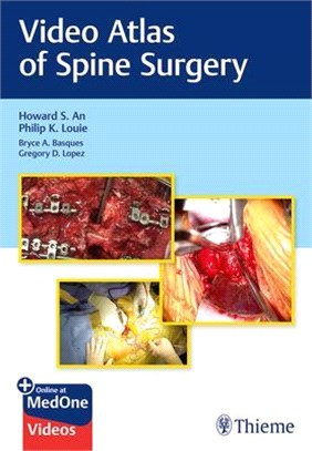 Video Atlas of Spine Surgery