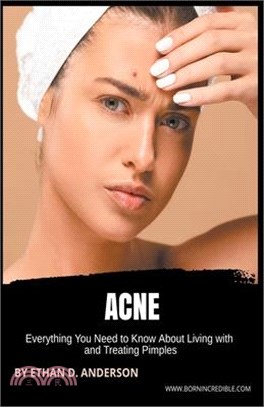 Acne: Everything You Need to Know About Living with and Treating Pimples