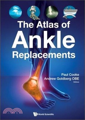 The Atlas of Ankle Replacements