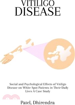 Social and Psychological Effects of Vitiligo Disease on White Spot Patients in Their Daily Lives A Case Study