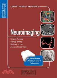 Neuroimaging