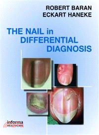 Nail in Differential Diagnosis