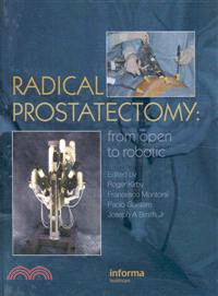 Radical Prostatectomy: From Open to Robotic