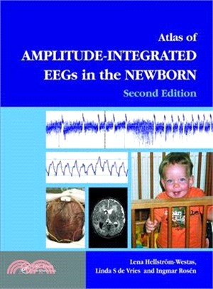 Atlas of Amplitude-Integrated EEGs in the Newborn