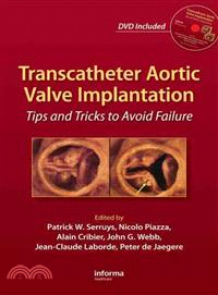 Transcatheter Aortic Valve Implantation ─ Tips and Tricks to Avoid Failure