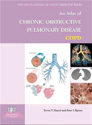 An Atlas of Chronic Obstructive Pulmonary Disease