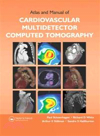 Atlas and Manual of Cardiovascular Multidetector Computed Tomography