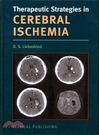 Therapeutic Strategies in Cerebral Ischemia