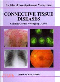 Connective Tissue Diseases