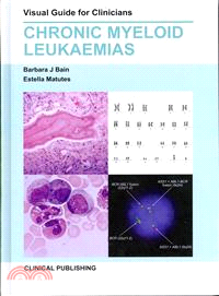 Chronic Myeloid Leukaemias