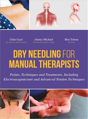 Dry Needling for Manual Therapists ─ Points, Techniques and Treatments, Including Electroacupuncture and Advanced Techniques