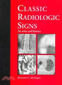 Classic Radiologic Signs：An Atlas and History