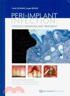 Peri-implant Infection: Etiology, Diagnosis and Treatment