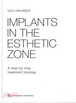Implants in the Esthetic Zone ─ A Step-by-Step Treatment Strategy