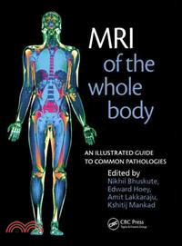 MRI of the Whole Body ─ An Illustrated Guide to Common Pathologies