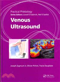 Venous Ultrasound