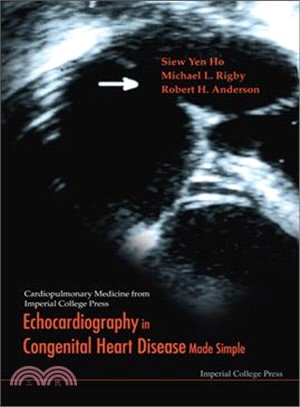 Echocardiography in Congenital Heart Disease Made Simple