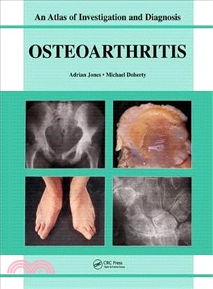 Oesteoarthritis：An Atlas of Investigation and Diagnosis